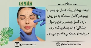 انواع لیفت شقیقه برای رفع چینوچروک