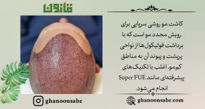 رویش مجدد مو با روش کاشت مو پیشرفته قانون | قانون سبز